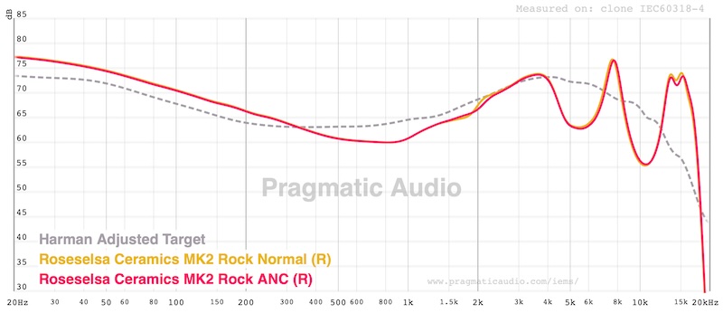 FR: ANC vs Normal — no measurable difference